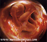feto semana 15ª a 16ª, semana 17ª a 18ª de embarazo gestacion
