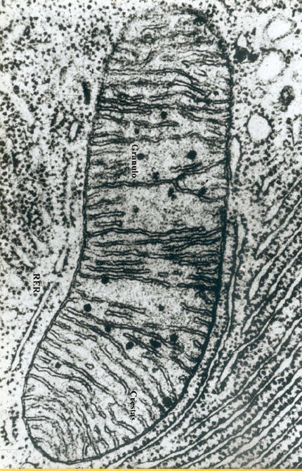 Mitocondria. Imagen tomada de http://www.med.uva.es/~biocel/Practicas/Apracticasbiolcel/p10/mitocondria.jpg