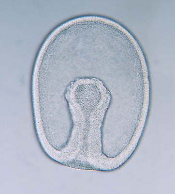 Gstrula, con arqunteron formado
