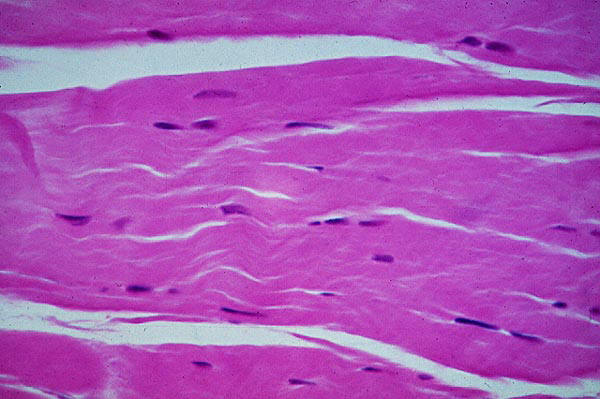 El tejido conjuntivo contiene gran cantidad de colgeno. Imagen de http://escuela.med.puc.cl/paginas/Cursos/segundo/histologia/HistologiaWeb/paginas/fotosBig/Fotos/c95CK203.jpg