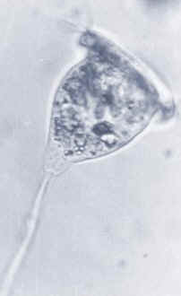 Vorticella es un protozoo ssil, es decir, fijo a un sustrato