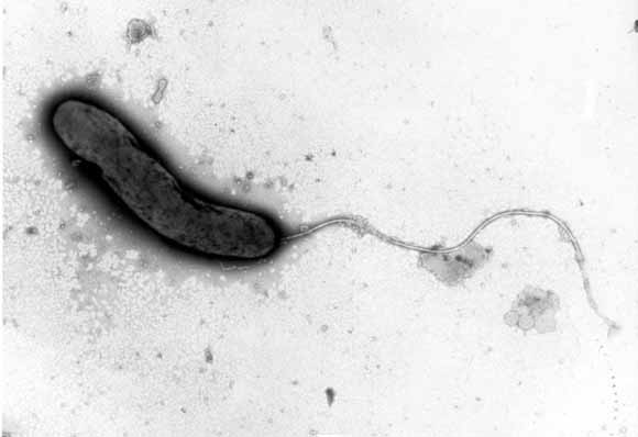 Los vibriones son bacterias alargadas, con un estremo ms estrecho, dando forma de "coma ortogrfica".