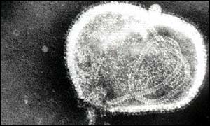 Virus de la gripe, al microscopio electrnico