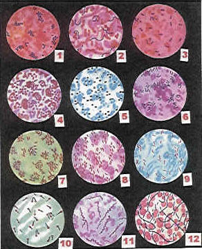 Observacin de distintas bacterias a microscopa ptica